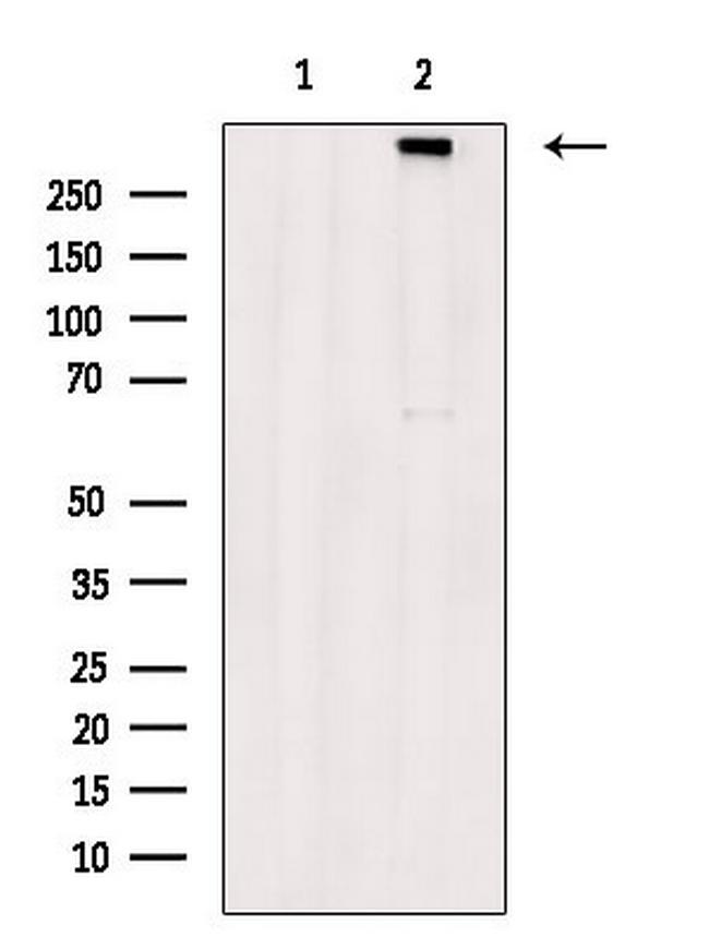 Phospho-RyR3 (Ser160) Antibody in Western Blot (WB)