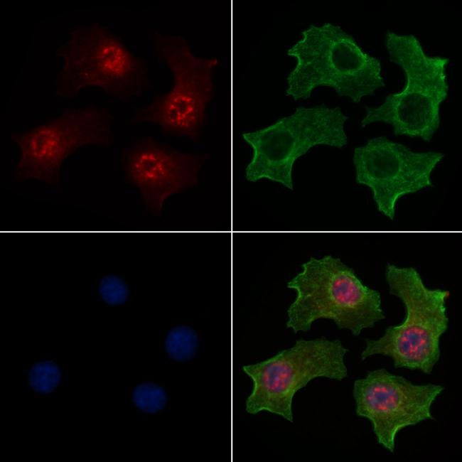 Phospho-WWTR1 (Ser66) Antibody in Immunocytochemistry (ICC/IF)