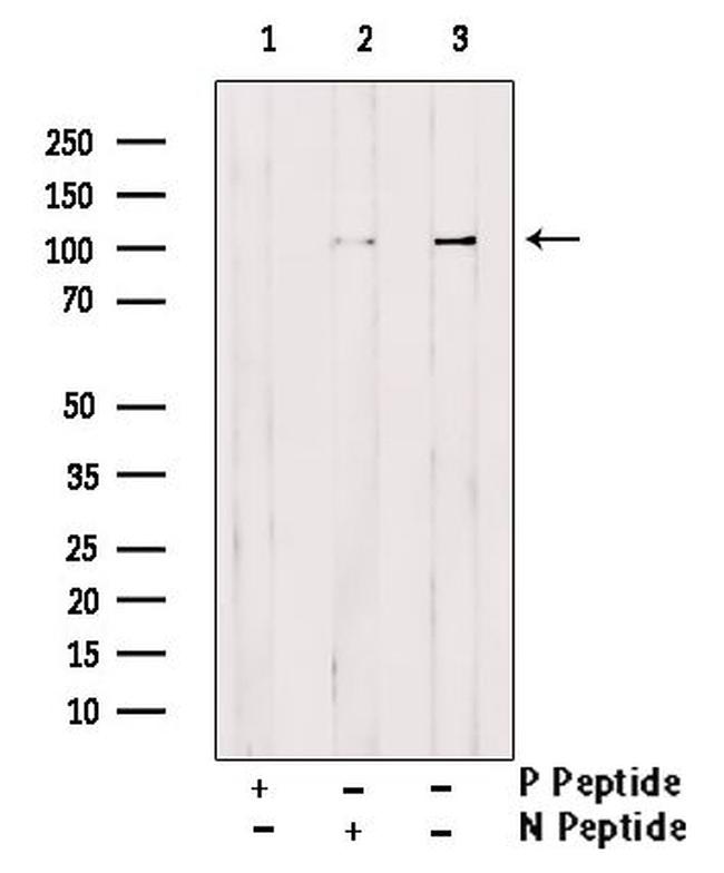 Phospho-alpha Actinin 1 (Tyr193) Antibody in Western Blot (WB)