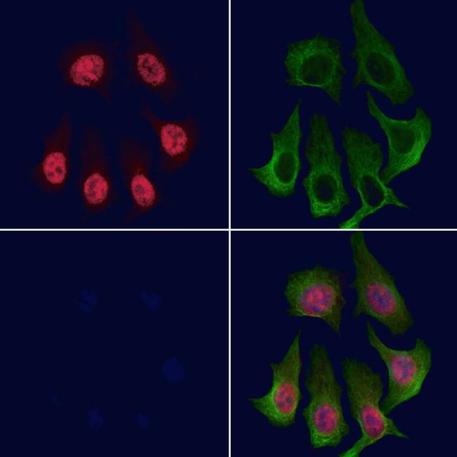 Phospho-BRG1 (Ser610) Antibody in Immunocytochemistry (ICC/IF)