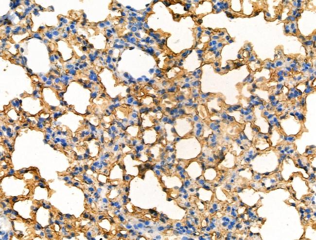 Phospho-CD32 (Tyr288) Antibody in Immunohistochemistry (Paraffin) (IHC (P))