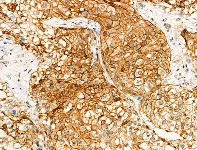 Phospho-LC3B (Thr29) Antibody in Immunohistochemistry (Paraffin) (IHC (P))