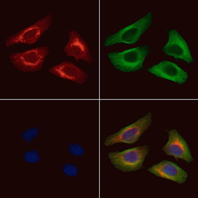 Acetyl-alpha Tubulin (Lys40) Antibody in Immunocytochemistry (ICC/IF)