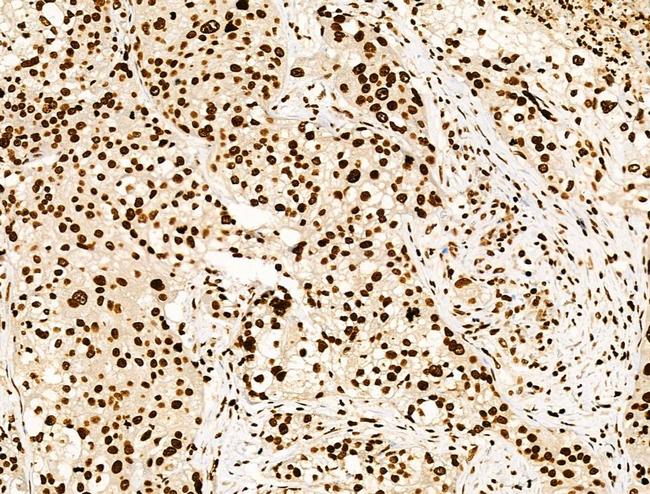 H4K91ac Antibody in Immunohistochemistry (Paraffin) (IHC (P))