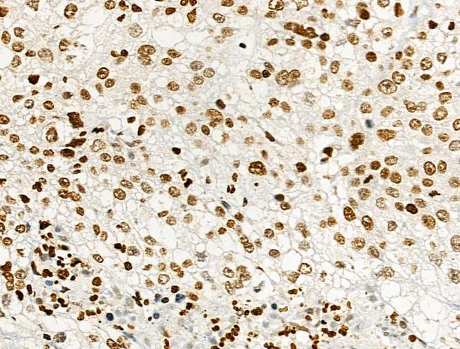 Phospho-Histone H2B (Tyr43) Antibody in Immunohistochemistry (Paraffin) (IHC (P))