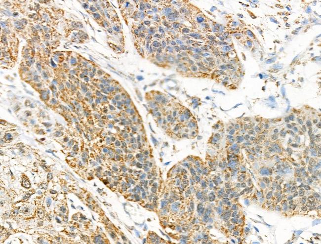 Acetyl-SOD2 (Lys122) Antibody in Immunohistochemistry (Paraffin) (IHC (P))