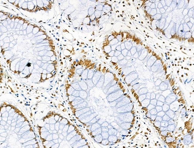 H3K122ac Antibody in Immunohistochemistry (Paraffin) (IHC (P))