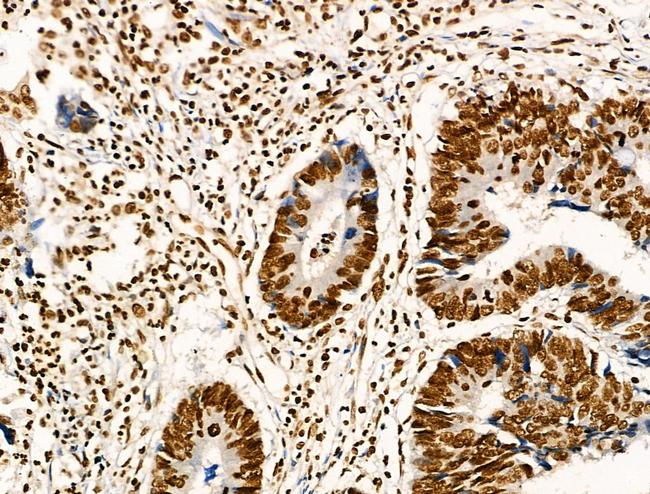 Acetyl-p53 (Lys373) Antibody in Immunohistochemistry (Paraffin) (IHC (P))