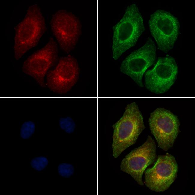 Phospho-PI3K p85 alpha (Tyr508) Antibody in Immunocytochemistry (ICC/IF)