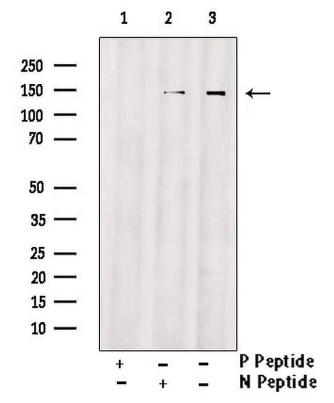 Phospho-EphA4 (Tyr596) Antibody in Western Blot (WB)