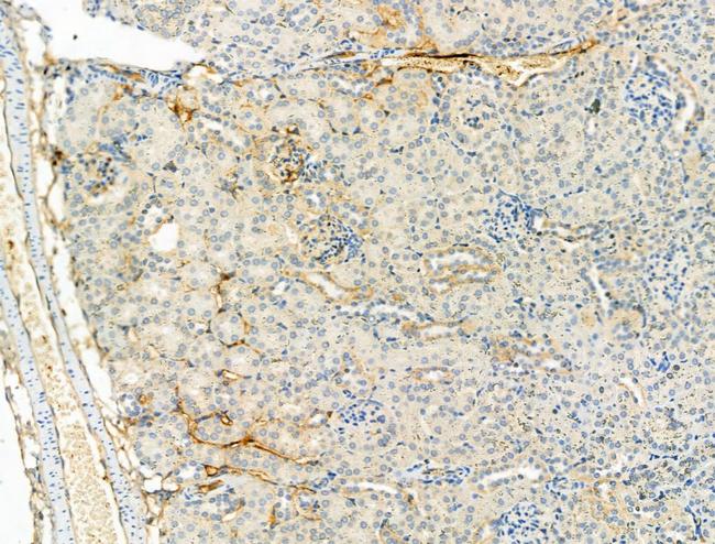 Phospho-ULK1 (Ser758) Antibody in Immunohistochemistry (Paraffin) (IHC (P))