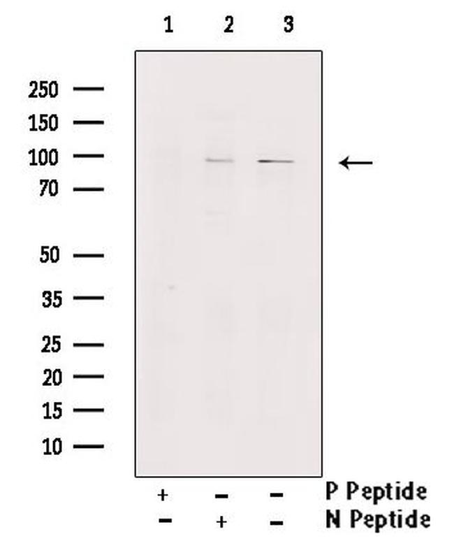 Phospho-INSR (Tyr1355) Antibody in Western Blot (WB)