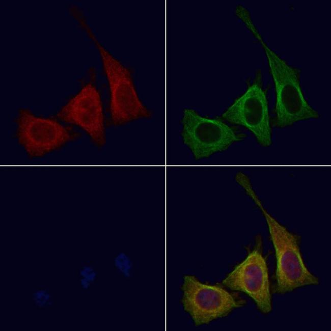 Phospho-CSF1R (Tyr708) Antibody in Immunocytochemistry (ICC/IF)