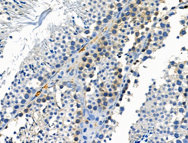 Phospho-CSF1R (Tyr723) Antibody in Immunohistochemistry (Paraffin) (IHC (P))