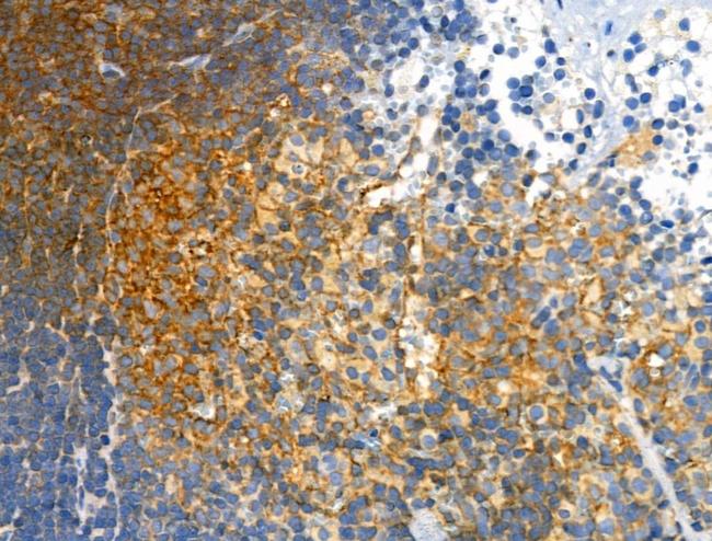 Phospho-PDGFRB (Tyr751) Antibody in Immunohistochemistry (Paraffin) (IHC (P))