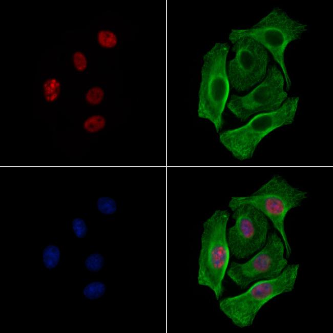 Phospho-ALOX5 (Ser272) Antibody in Immunocytochemistry (ICC/IF)