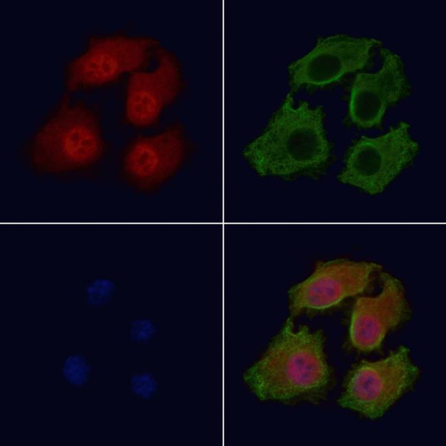 Phospho-Bcl-2 (Thr56) Antibody in Immunocytochemistry (ICC/IF)