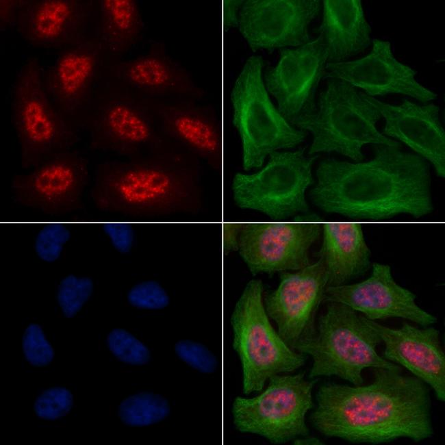 Phospho-SRC (Ser17) Antibody in Immunocytochemistry (ICC/IF)