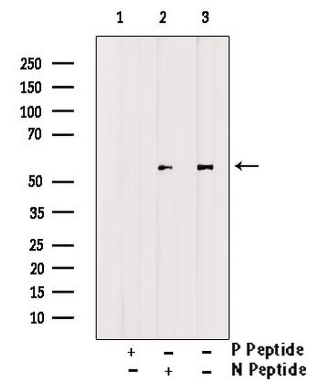 Phospho-Cyclin B1 (Ser116) Antibody in Western Blot (WB)