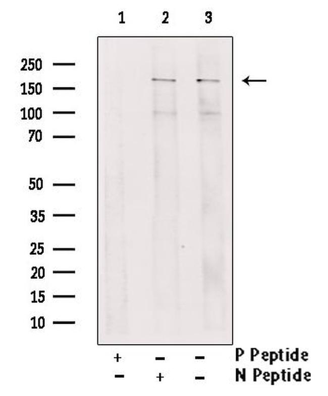 Phospho-IRS1 (Ser1101) Antibody in Western Blot (WB)