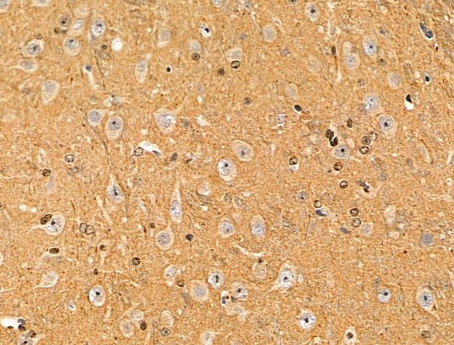 Phospho-VEGF Receptor 2 (Tyr1175) Antibody in Immunohistochemistry (Paraffin) (IHC (P))