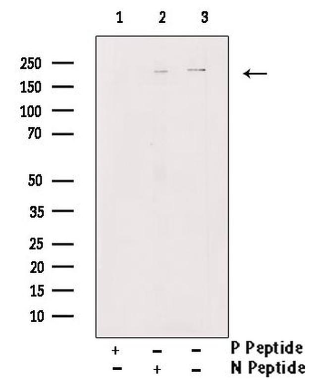 Phospho-TSC2 (Tyr1571) Antibody in Western Blot (WB)