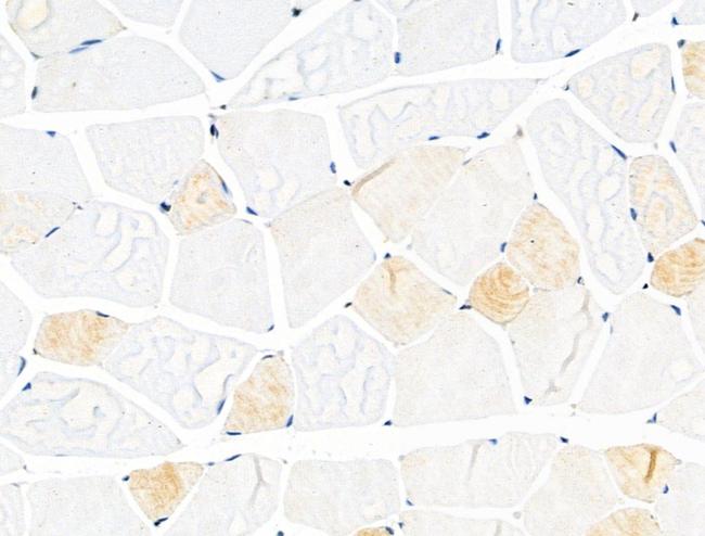 Phospho-KIF11 (Thr926) Antibody in Immunohistochemistry (Paraffin) (IHC (P))