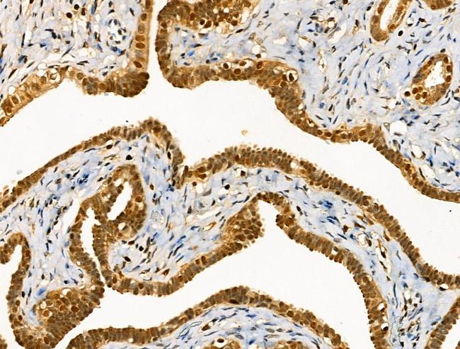 Phospho-PKC delta (Ser645) Antibody in Immunohistochemistry (Paraffin) (IHC (P))