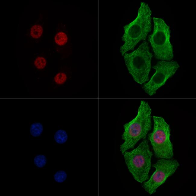 Phospho-FOXM1 (Ser35) Antibody in Immunocytochemistry (ICC/IF)