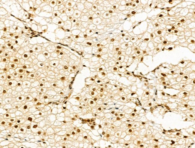 Phospho-PAK1/PAK2 (Thr423, Thr402) Antibody in Immunohistochemistry (Paraffin) (IHC (P))