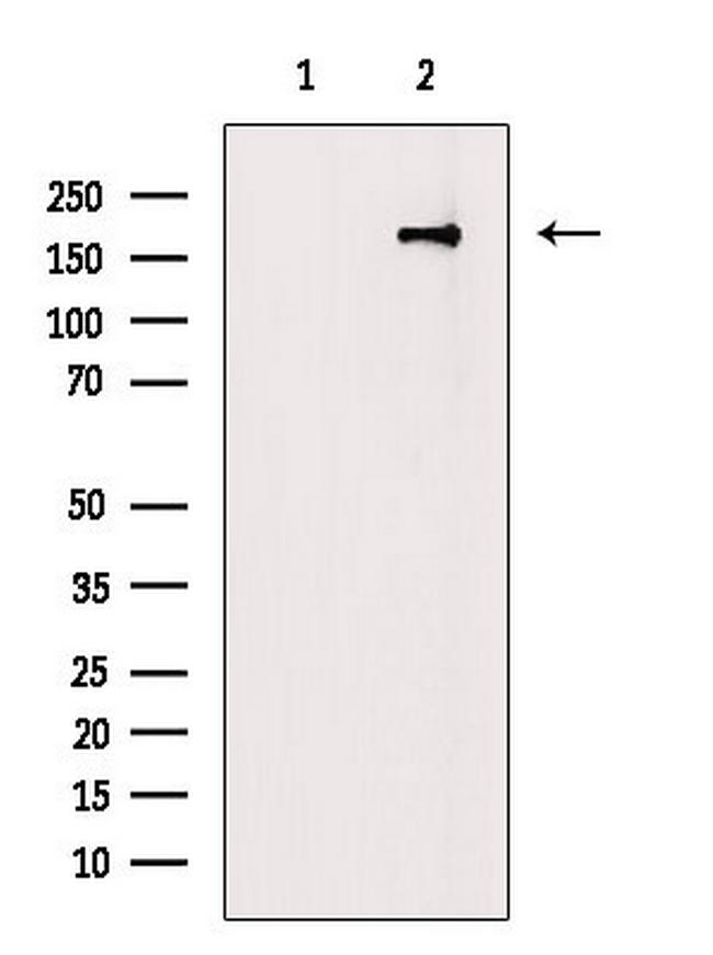 Phospho-NMDAR2B (Tyr1070) Antibody in Western Blot (WB)