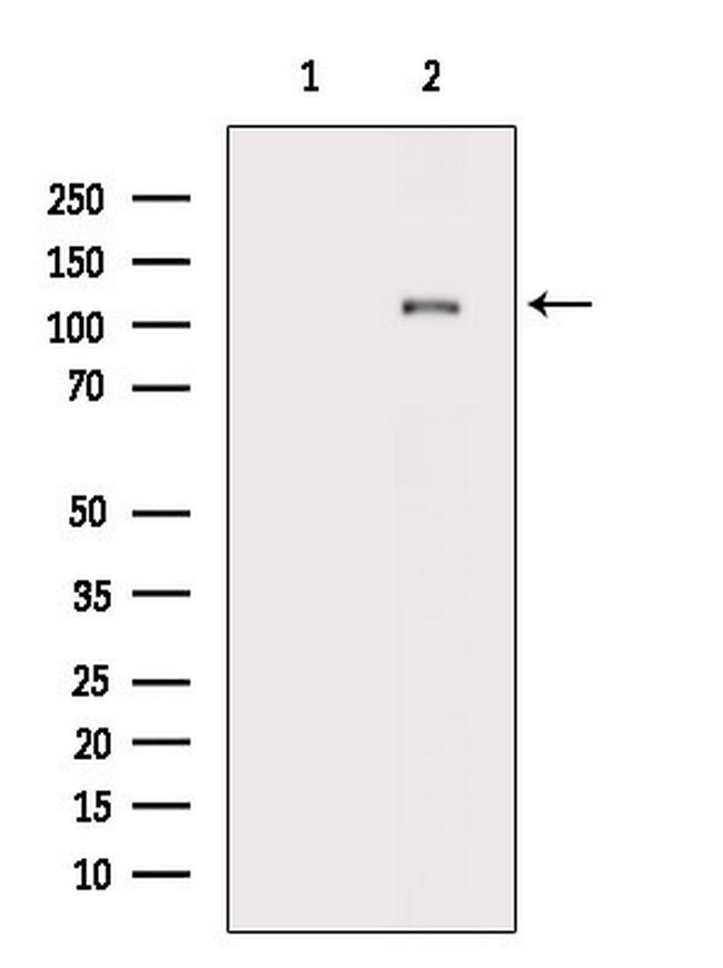 Phospho-PLD1 (Thr147) Antibody in Western Blot (WB)