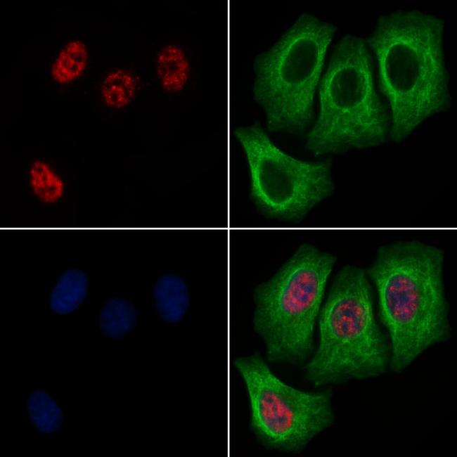 Phospho-PPIG (Ser376) Antibody in Immunocytochemistry (ICC/IF)