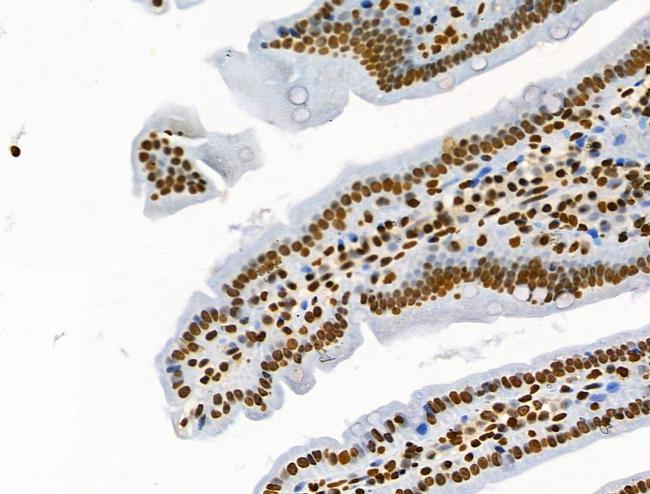 Phospho-BRK (Tyr447) Antibody in Immunohistochemistry (Paraffin) (IHC (P))