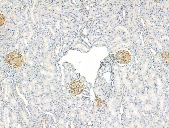 Phospho-RAPGEF1 (Thr1071) Antibody in Immunohistochemistry (Paraffin) (IHC (P))