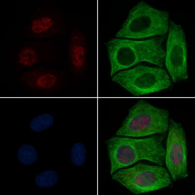 Phospho-RUNX2 (Ser340) Antibody in Immunocytochemistry (ICC/IF)