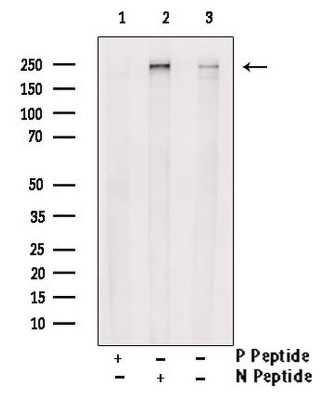 Phospho-SCRIB (Ser1220) Antibody in Western Blot (WB)