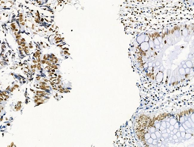 Phospho-GIT2 (Tyr592) Antibody in Immunohistochemistry (Paraffin) (IHC (P))