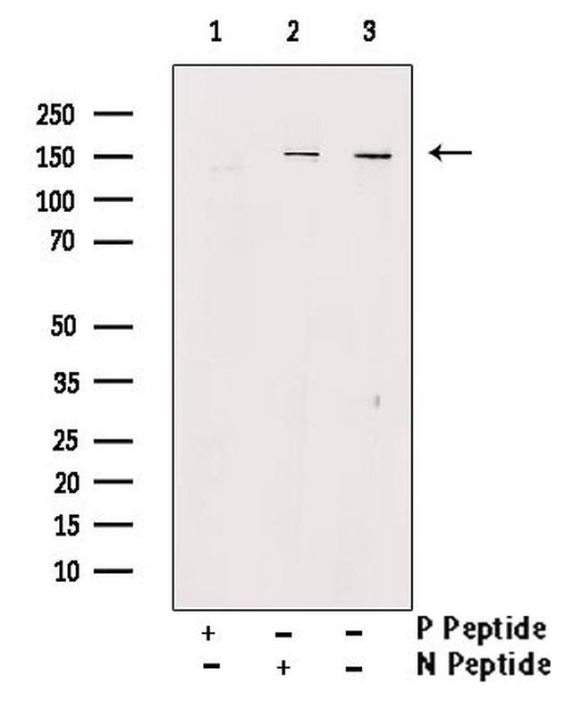 Phospho-SMC1 (Ser360) Antibody in Western Blot (WB)