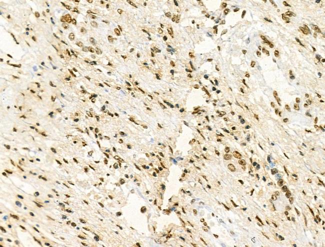 Phospho-IRF4 (Tyr122, Tyr125) Antibody in Immunohistochemistry (Paraffin) (IHC (P))