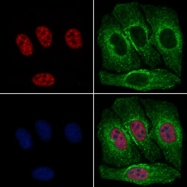 Phospho-RSK1 (Thr573) Antibody in Immunocytochemistry (ICC/IF)