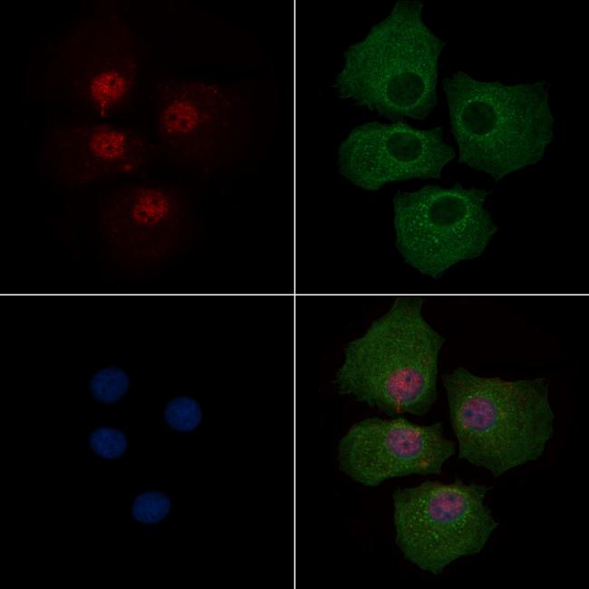 Phospho-PAR4 (Thr163) Antibody in Immunocytochemistry (ICC/IF)