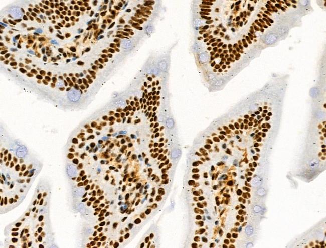 Phospho-MNK1 (Thr250, Thr255) Antibody in Immunohistochemistry (Paraffin) (IHC (P))