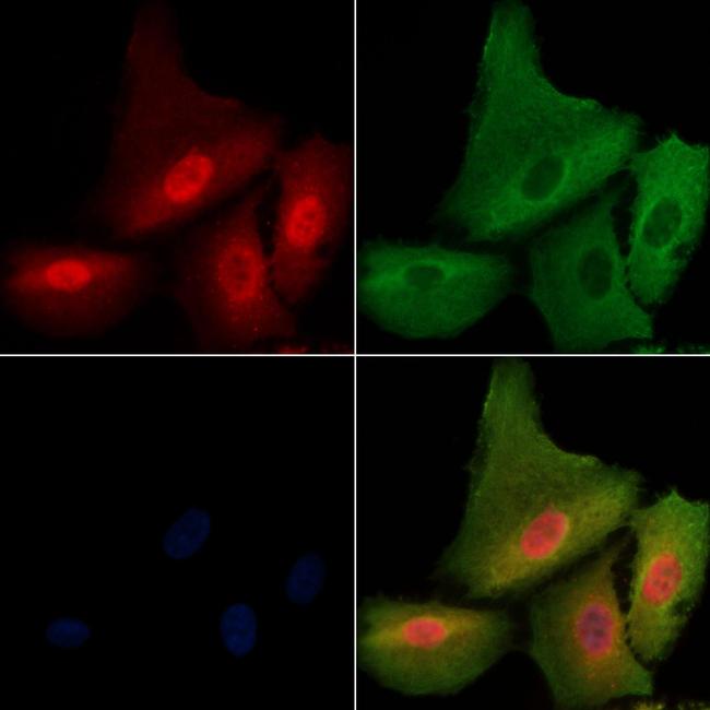 Phospho-ATF6 (Thr166) Antibody in Immunocytochemistry (ICC/IF)