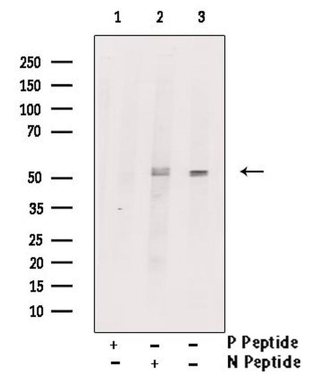 Phospho-RIP3 (Ser316) Antibody in Western Blot (WB)