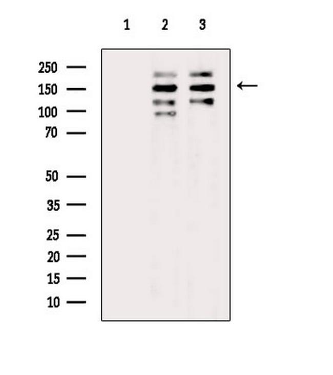 53BP2 Antibody in Western Blot (WB)