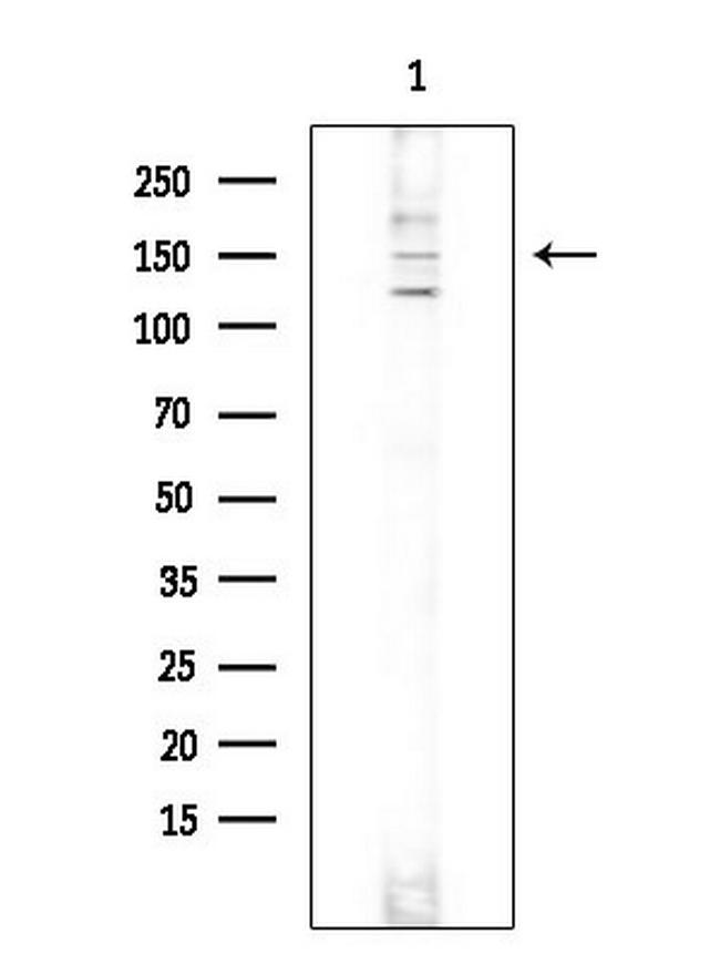 SOS1 Antibody in Western Blot (WB)