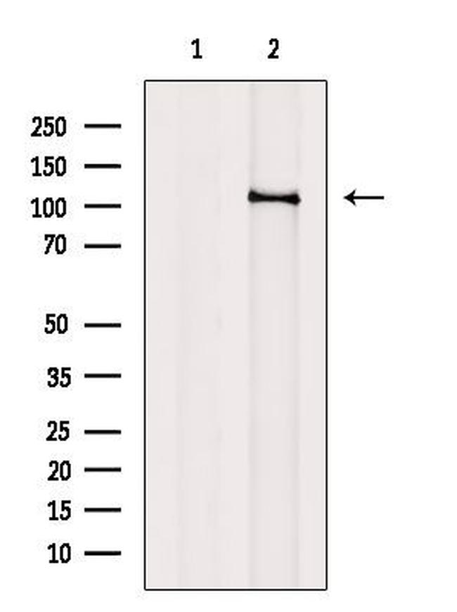 PCAF Antibody in Western Blot (WB)