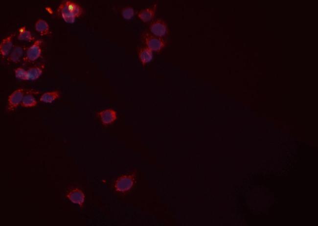 Rad52 Antibody in Immunocytochemistry (ICC/IF)