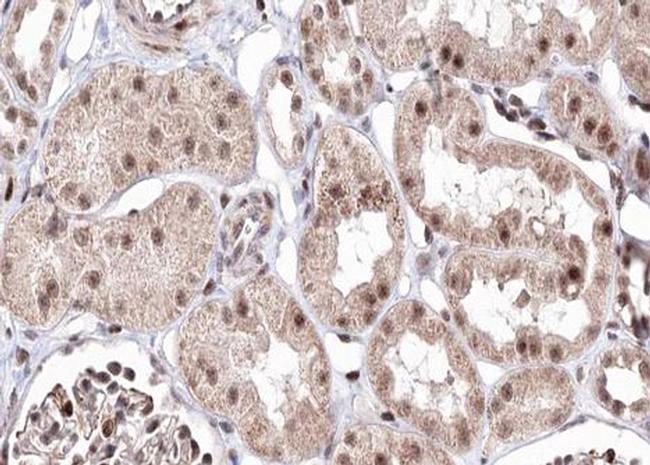 BMP-7 Antibody in Immunohistochemistry (Paraffin) (IHC (P))